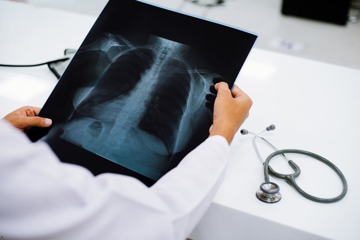 Es fundamental realizarse pruebas periódicas para evaluar la salud de los huesos y prevenir enfermedades como la osteopenia o la osteoporosis.